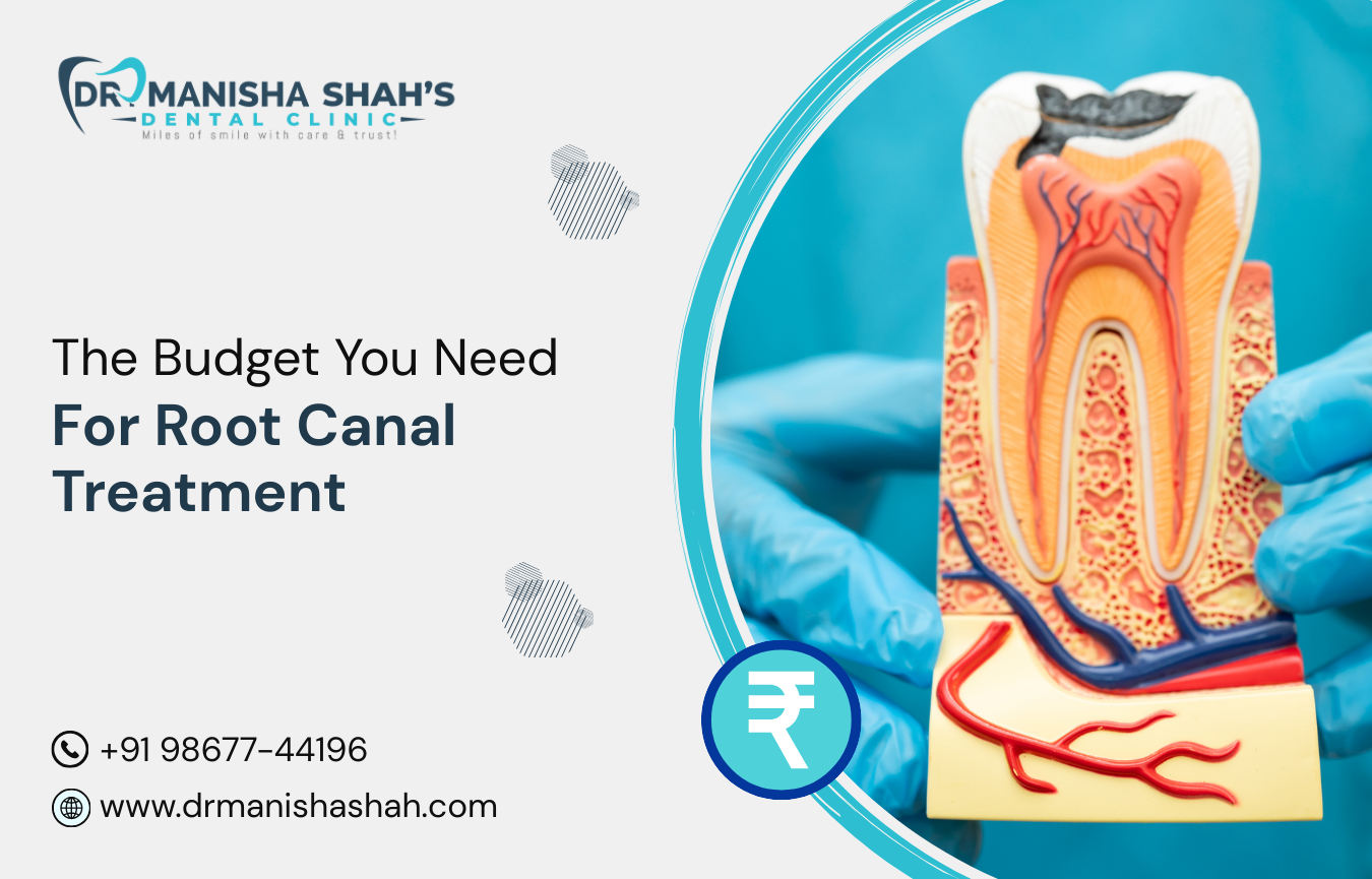 The Budget You Need for Root Canal Treatment